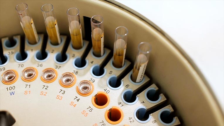 3 Takeaways From Large-Cap Pharma Earnings